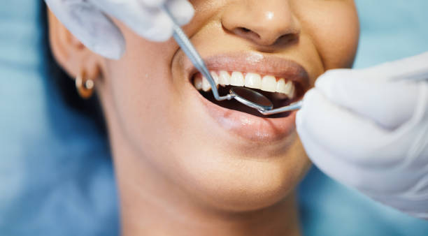 Best Pediatric Emergency Dentist in Bay Park, NY